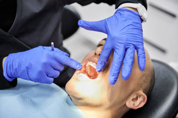 Best Knocked-Out Tooth Emergency  in Amboy, WA